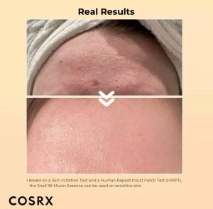 اسنس حلزون کوزارکس | COSRX snail mucin essence - Image 5