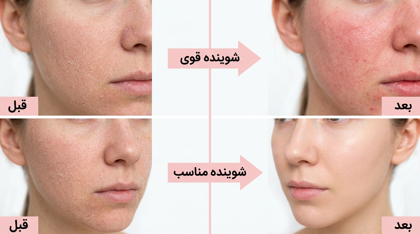 راهنمای شوینده صورت - بخش 3