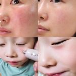 کرم ترمیم‌کننده پیشرفته آپومدرم | Apomederm Breath Dressing Cream - Image 6